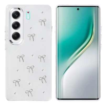 Tecno Camon 40 4G Kılıf Airbag Tasarımlı Simli Şeffaf Zore Kutup Kapak Fiyonk