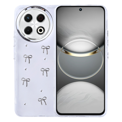 Tecno Spark 30 Pro 5G Case Airbag Design Glitter Transparent Zore Kutup Cover Fiyonk