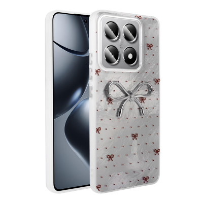 Xiaomi 14T Case Camera Protection Figured Zore Ponti Silicone Cover Açık Mavi