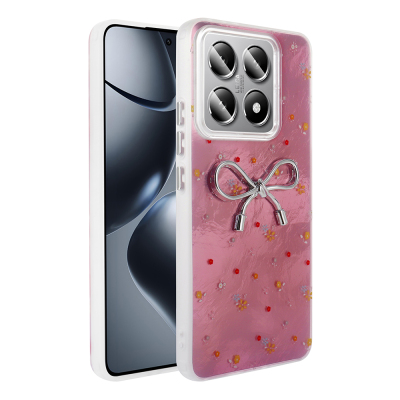 Xiaomi 14T Pro Case Camera Protection Figured Zore Ponti Silicone Cover Açık Pembe