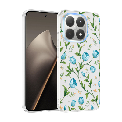 Xiaomi 15T Case with Camera Protector, Patterned Zore Clip Cover Mavi Lale