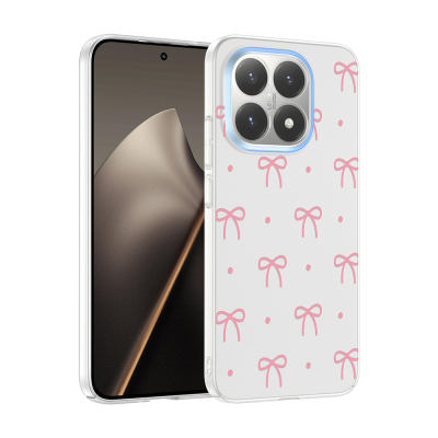 Xiaomi 15T Kılıf Kamera Korumalı Desenli Zore Klip Kapak Fiyonk