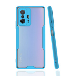 Xiaomi Mi 11T 5G Case Zore Parfe Cover Blue