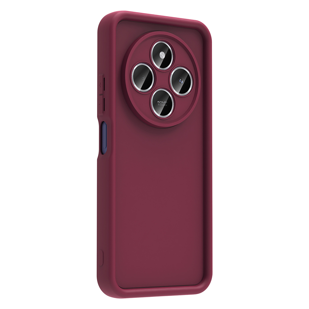 Xiaomi Redmi 14C Case Camera Protection Zore Ananas Cover - 10
