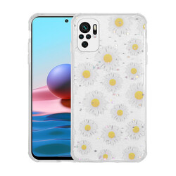 Xiaomi Redmi Note 10 Case Glittery Patterned Camera Protected Shiny Zore Popy Cover Papatya