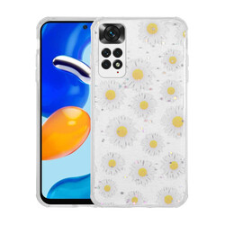 Xiaomi Redmi Note 11 Global Case Glittery Patterned Camera Protected Shiny Zore Popy Cover Papatya