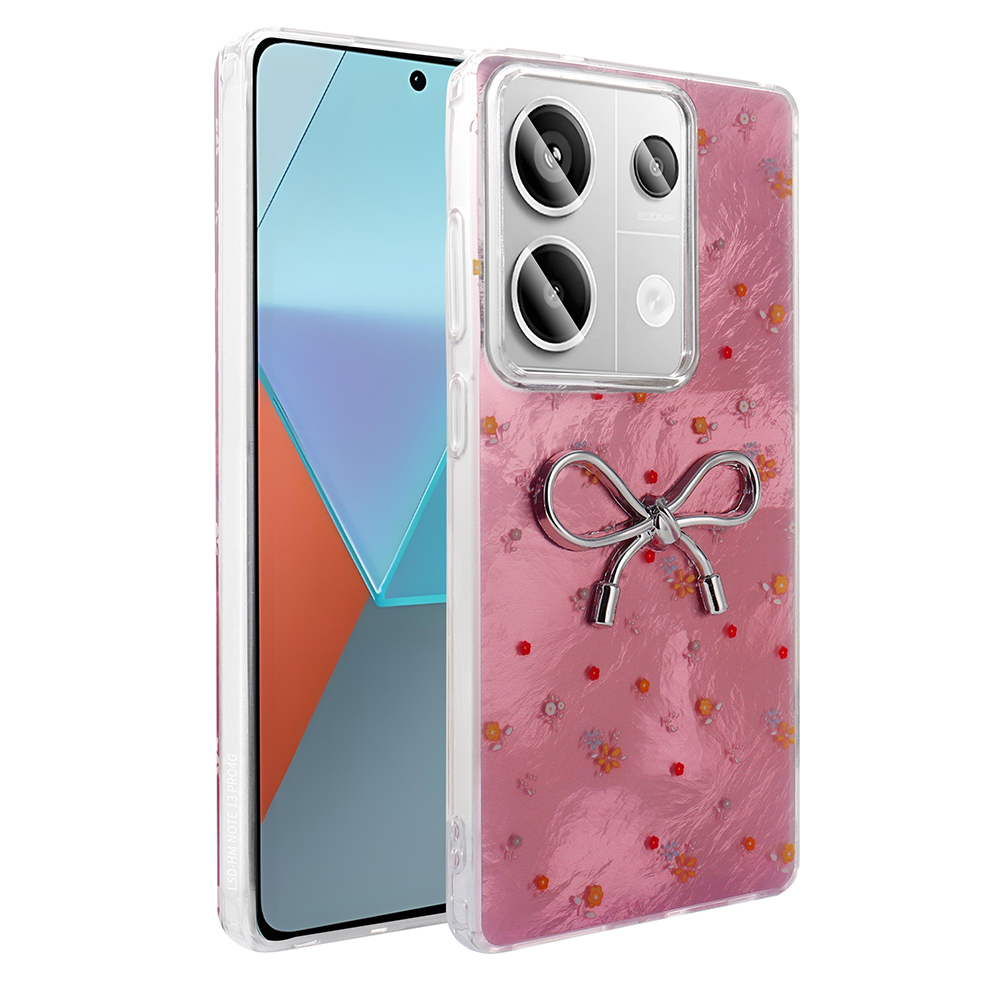 Xiaomi Redmi Note 13 Pro 4G Case Camera Protection Figured Zore Ponti Silicone Cover - 3