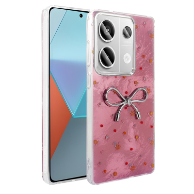 Xiaomi Redmi Note 13 Pro 4G Case Camera Protection Figured Zore Ponti Silicone Cover Açık Pembe