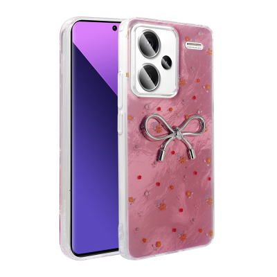 Xiaomi Redmi Note 13 Pro Plus 5G Case Camera Protection Figured Zore Ponti Silicone Cover Açık Pembe