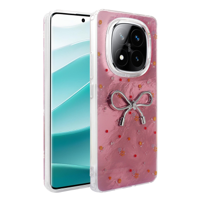 Xiaomi Redmi Note 14 Pro 4G Case Camera Protection Figured Zore Ponti Silicone Cover Açık Pembe