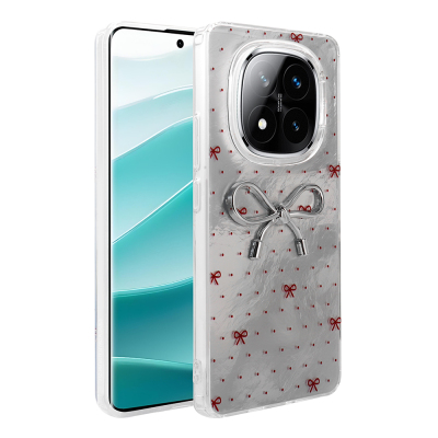 Xiaomi Redmi Note 14 Pro 5G Case Camera Protection Figured Zore Ponti Silicone Cover Açık Mavi