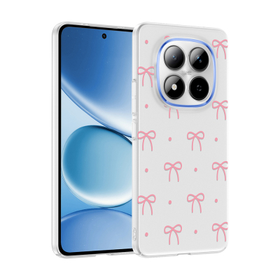 Xiaomi Redmi Note 15 Pro Kılıf Kamera Korumalı Desenli Zore Klip Kapak Fiyonk