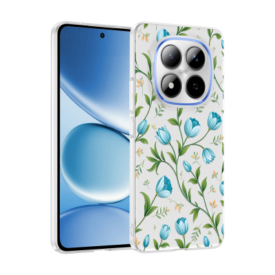 Xiaomi Redmi Note 15 Pro Kılıf Kamera Korumalı Desenli Zore Klip Kapak Mavi Lale